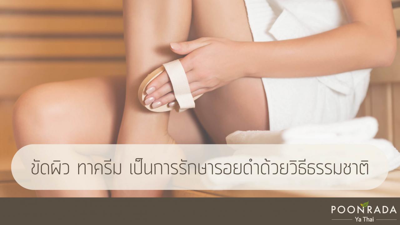 ขาลาย_รอยดำ_แพ้ยุง-3