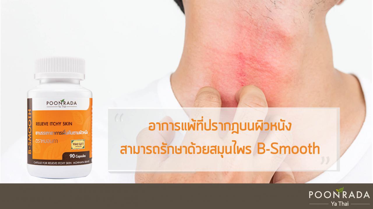 ทำไมถึงมีอาการแพ้สิ่งที่ไม่เคยแพ้มาก่อน_แล้วจะหายแพ้ได้ไหม-4