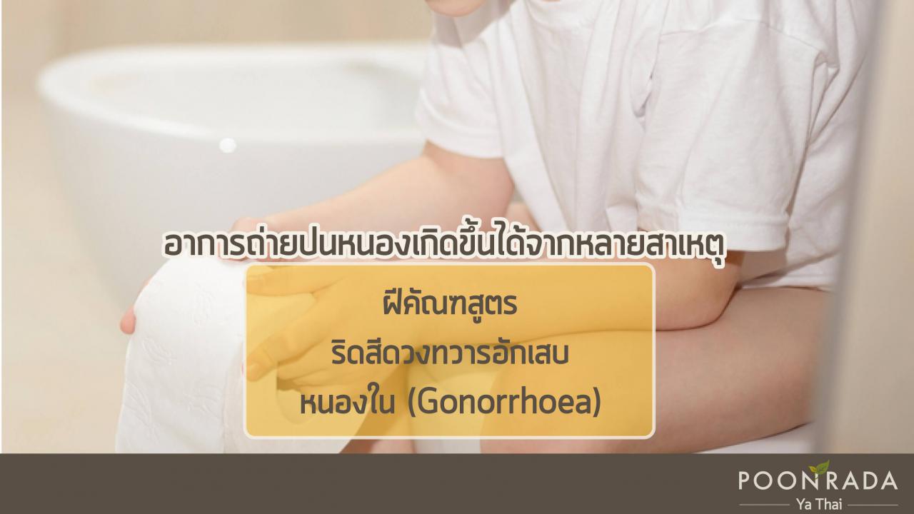 ถ่ายปนหนอง_ฝีคัณฑสูตรเรื้อรัง-2