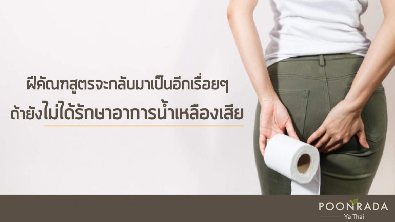 ฝีคัณฑสูตร_หายเองได้_ไม่ต้องผ่า-2