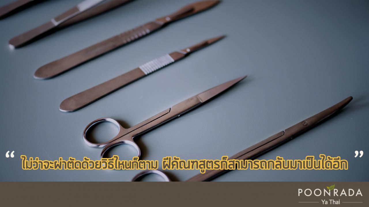 ฝีคัณฑสูตร_หายเองได้_ไม่ต้องผ่า-3