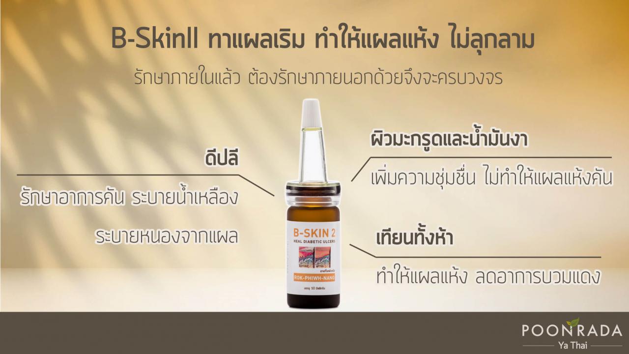 เริมที่ฝ่ามือ_รักษาอย่างไร-5