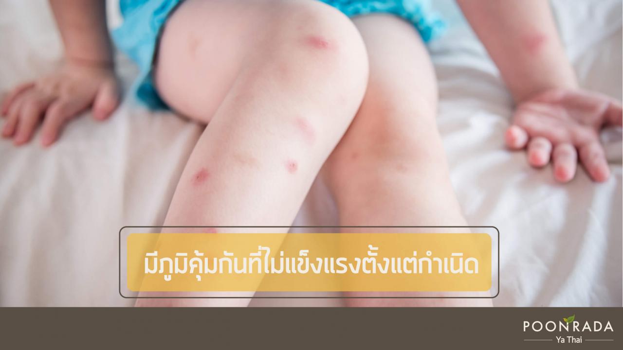 6_สาเหตุของโรคน้ำเหลืองเสีย-6