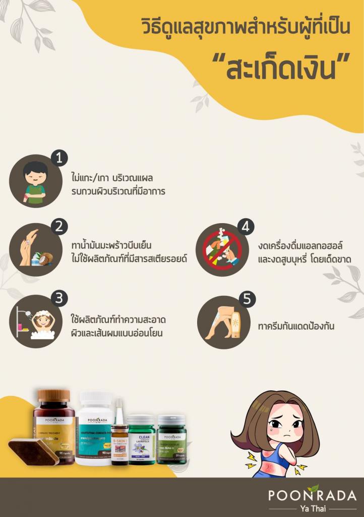 วิธีดูแลสุขภาพผู้เป็นสะเก็ดเงิน