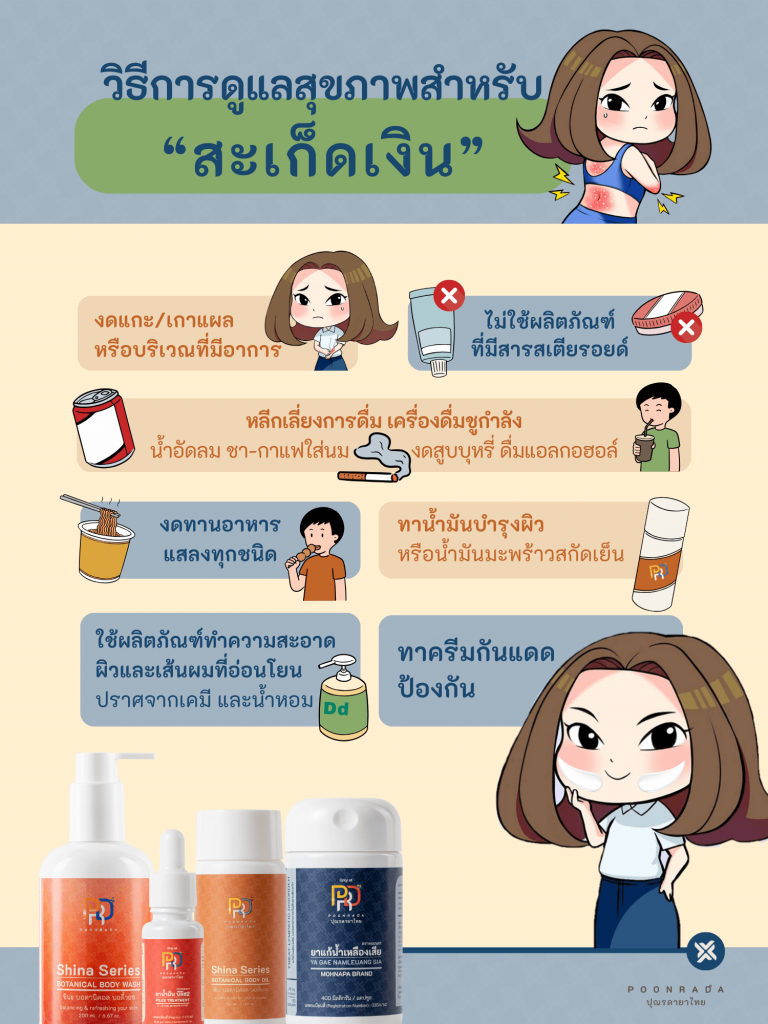 วิธีดูแลสุขภาพผู้เป็นสะเก็ดเงิน