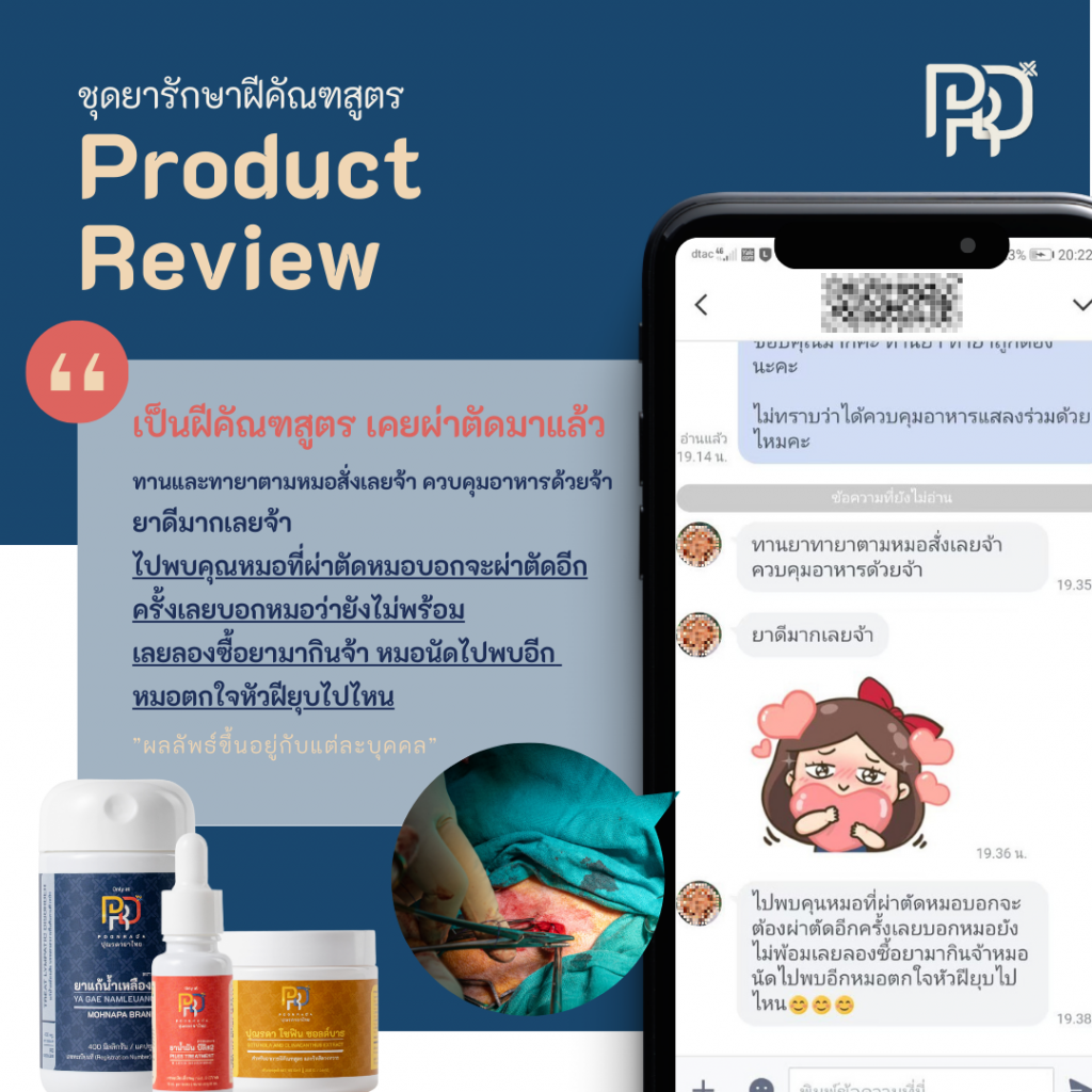 รีวิว ยารักษาฝีคัณฑสูตรและฝีที่ก้น A-set เคยผ่าตัด