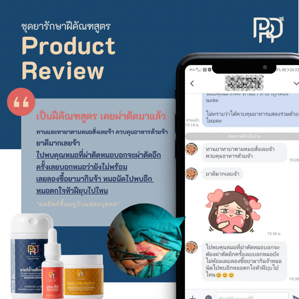 รีวิว ชุดรักษาฝฝีคัณฑสูตร A-set เคยผ่าตัด