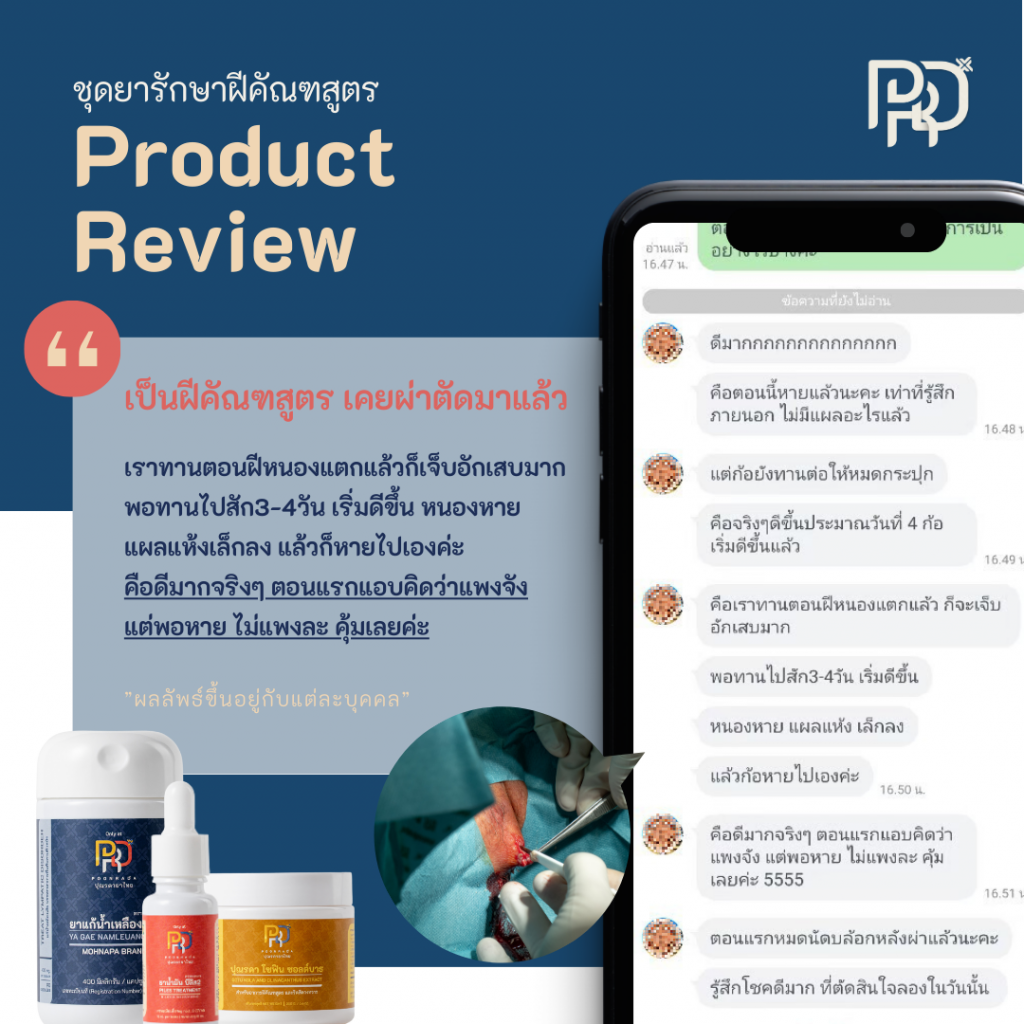 รีวิว5 ยารักษาฝีคัณฑสูตรและฝีที่ก้น A-set เคยผ่าตัด