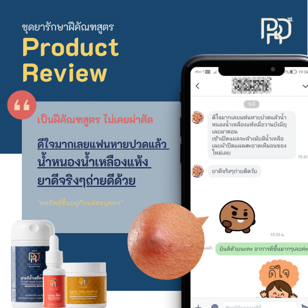 รีวิว ชุดรักษาฝฝีคัณฑสูตร A-set ไม่เคยผ่าตัด