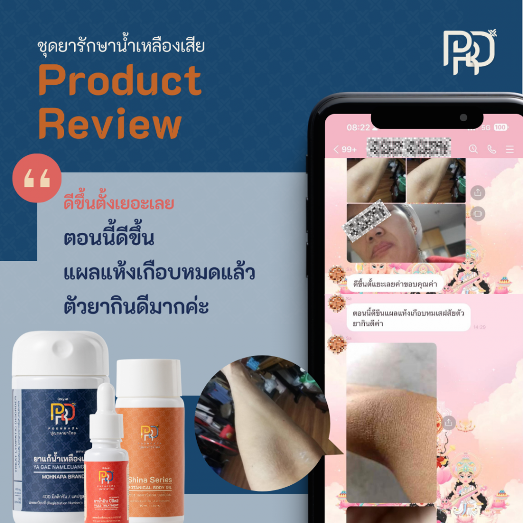 รีวิว ชุดยาแก้น้ำเหลืองเสีย LT-SET+