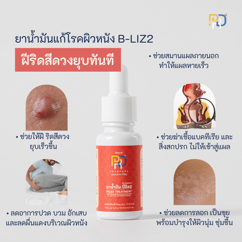 สรรพคุณ ยาน้ำมันบีลิส2 b-liz2 oil ยาทาฝีคัณฑสูตร