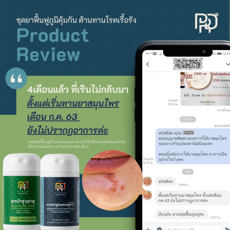 รีวิวสมุนไพรฟื้นฟูภูมิคุ้มกัน ช่วยต้านทานโรคเรื้อรัง B-BOOST SET