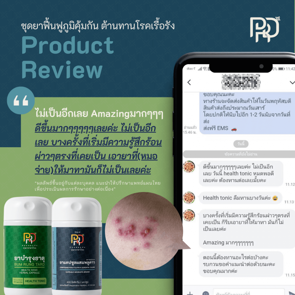 รีวิวสมุนไพรฟื้นฟูภูมิคุ้มกัน ช่วยต้านทานโรคเรื้อรัง B-BOOST SET