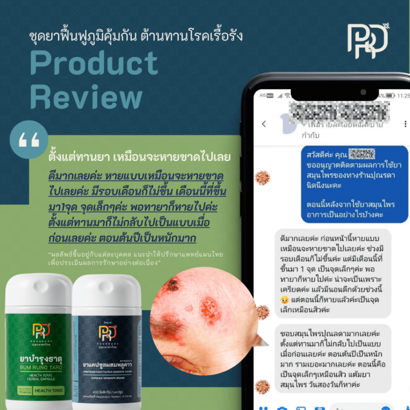 รีวิวสมุนไพรฟื้นฟูภูมิคุ้มกัน ช่วยต้านทานโรคเรื้อรัง B-BOOST SET