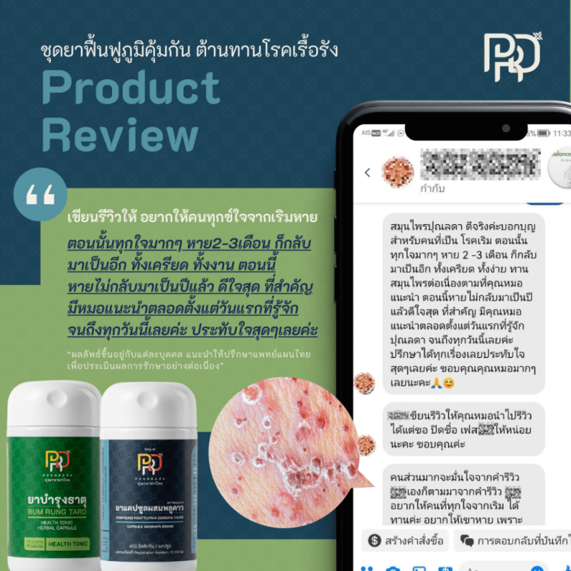 รีวิวสมุนไพรฟื้นฟูภูมิคุ้มกัน ช่วยต้านทานโรคเรื้อรัง B-BOOST SET