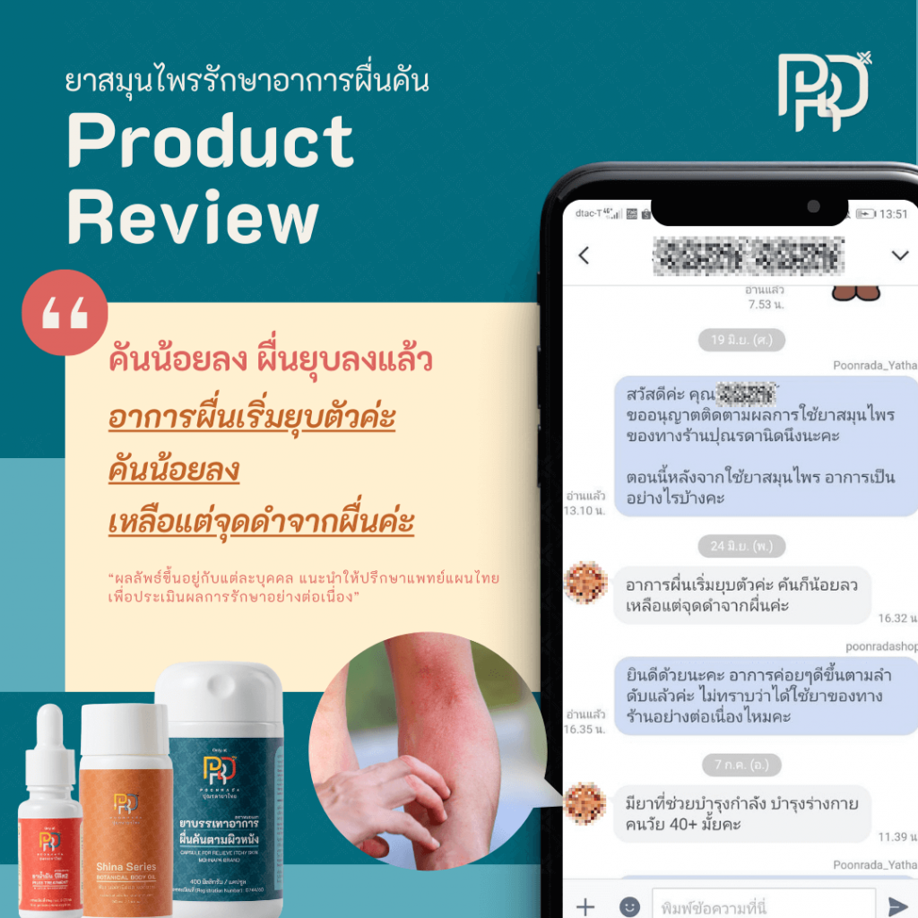 รีวีวจากผู้ใช้ b-smooth ยาแก้ผื่นคัน น้ำเหลืองเสีย 5