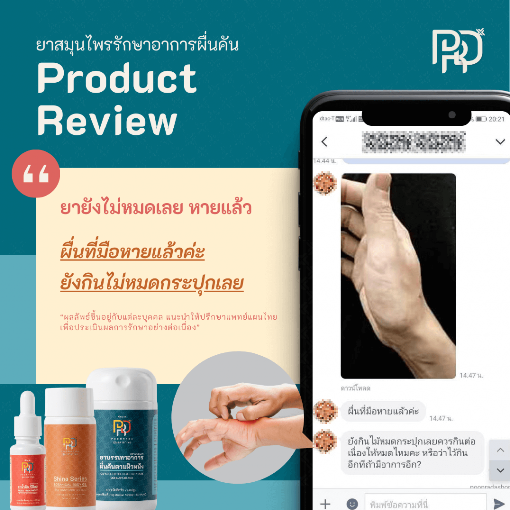 รีวีวจากผู้ใช้ b-smooth ยาแก้ผื่นคัน น้ำเหลืองเสีย 4