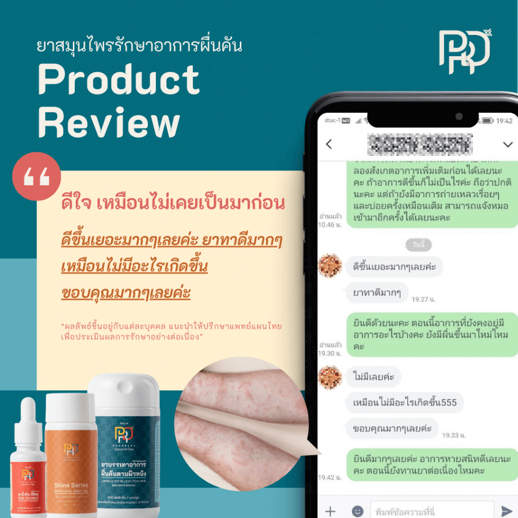 รีวีวจากผู้ใช้ b-smooth ยาแก้ผื่นคัน น้ำเหลืองเสีย 3