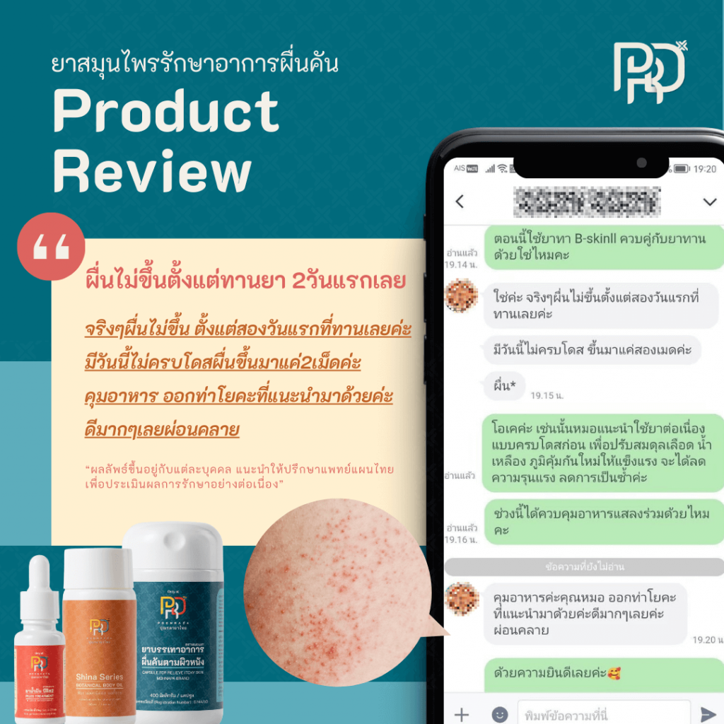 รีวีว จากผู้ใช้ b-smooth ยาแก้ผื่นคัน น้ำเหลืองเสีย 2