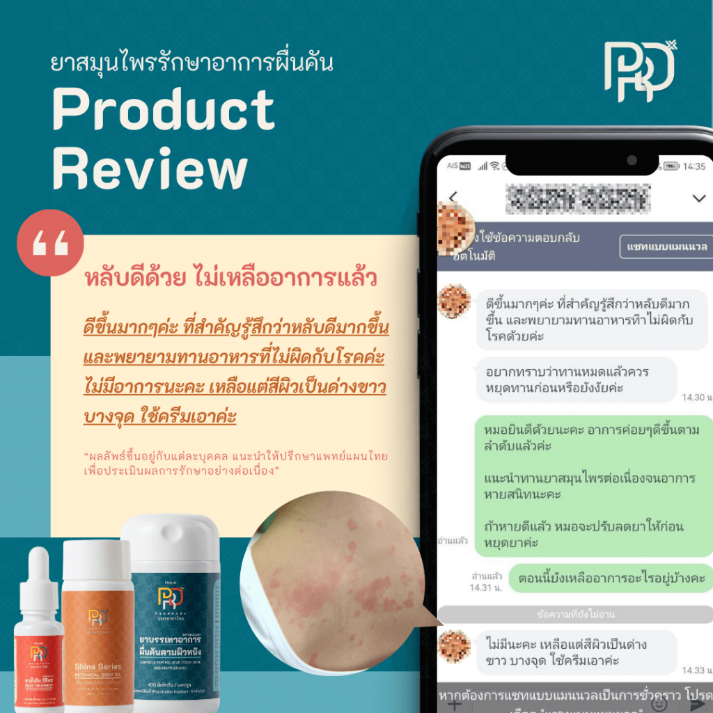 รีวีวจากผู้ใช้ b-smooth ยาแก้ผื่นคัน น้ำเหลืองเสีย