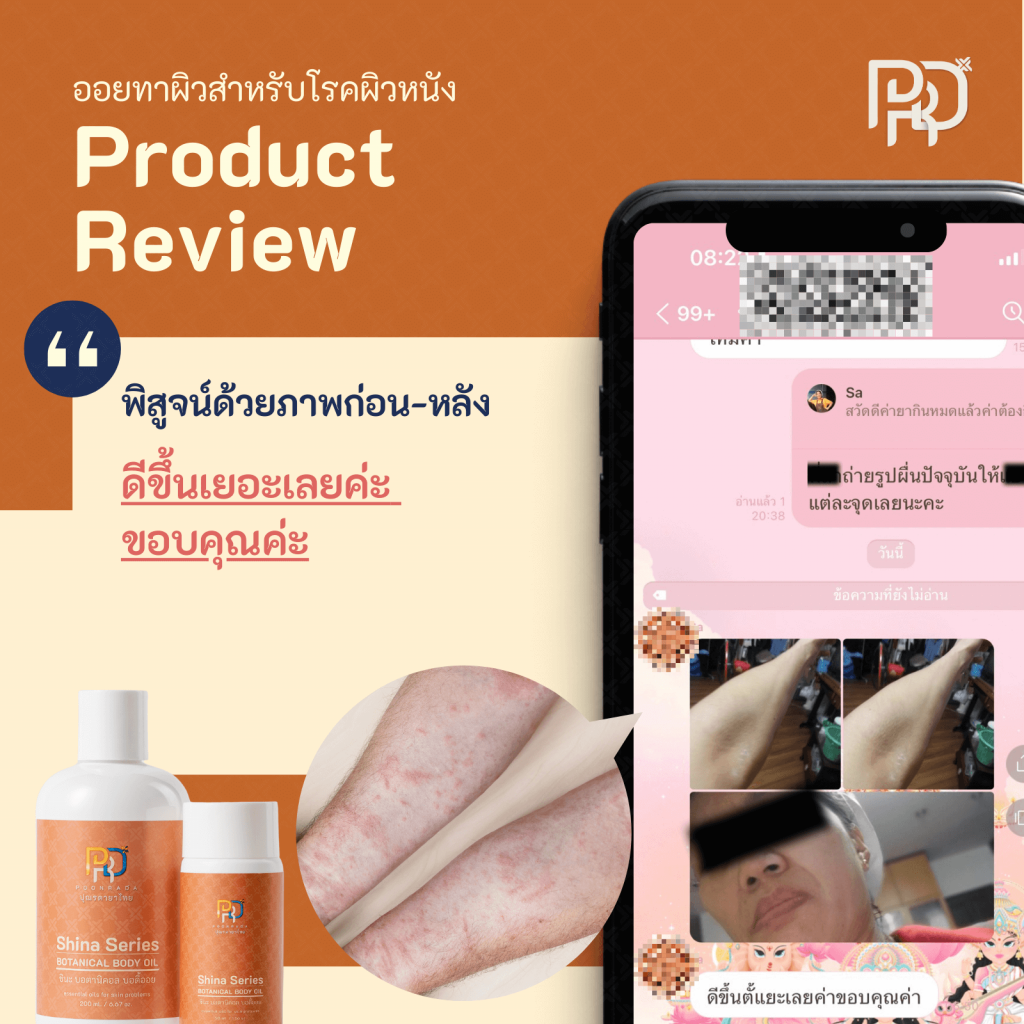รีวิว ประสบการณ์จากผู้ใช้ Shina Body Oil