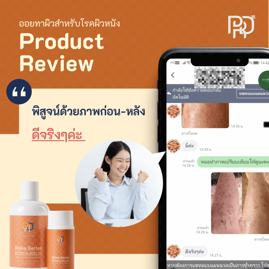 รีวิว ประสบการณ์จากผู้ใช้Shina Body Oil