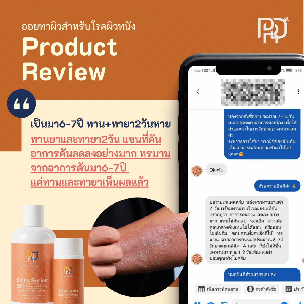 รีวิว ประสบการณ์จากผู้ใช้Shina Body Oil