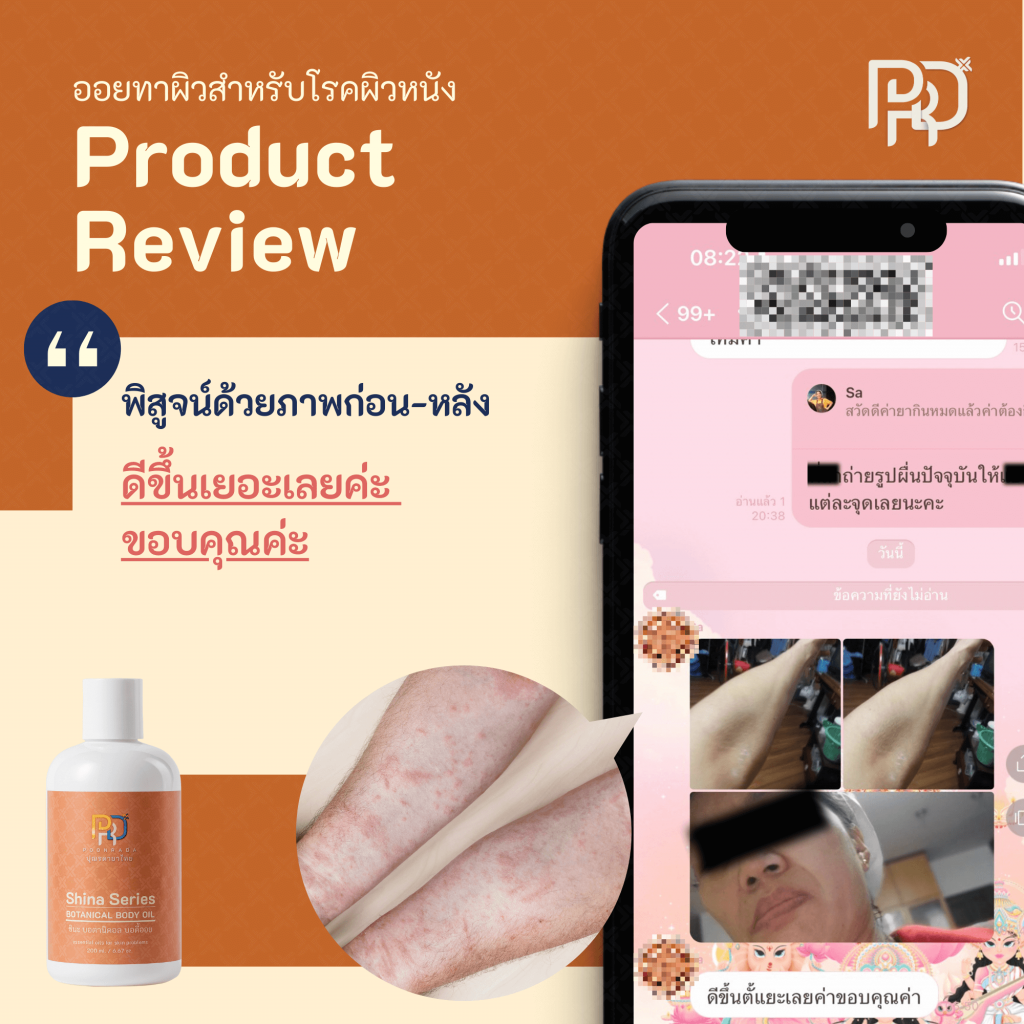 รีวิว ประสบการณ์จากผู้ใช้ Shina Body Oil