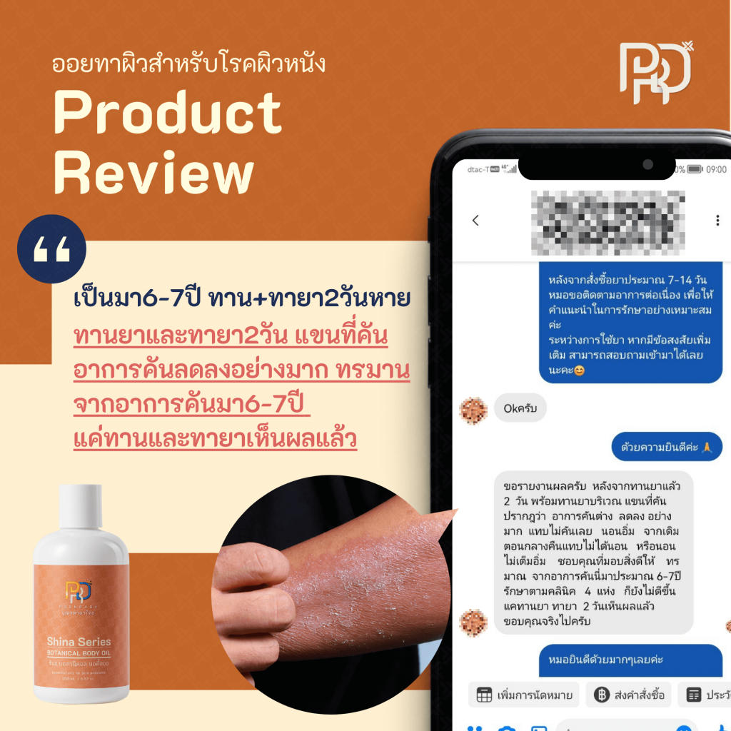 รีวิว ประสบการณ์จากผู้ใช้Shina Body Oil