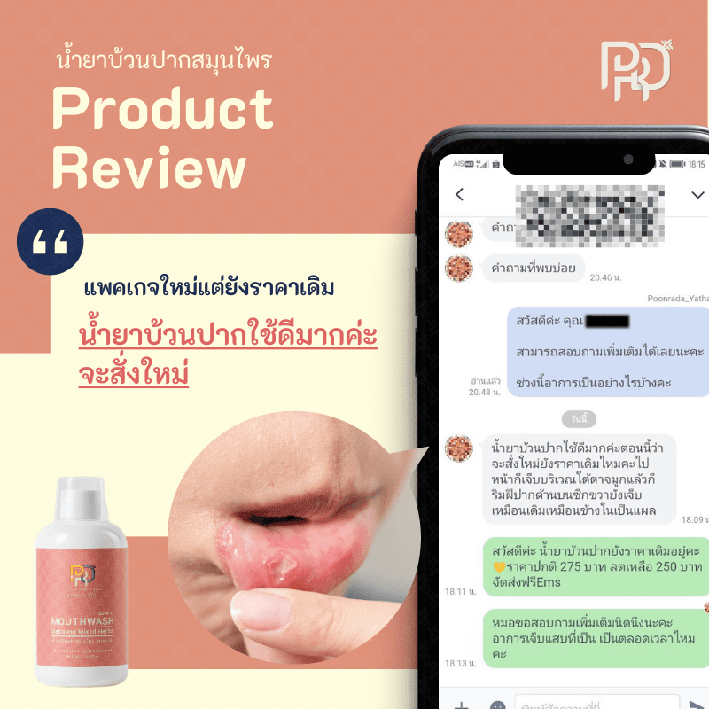 รีวิวประสบการณ์ ยาแก้เหงือกอักเสบ 17