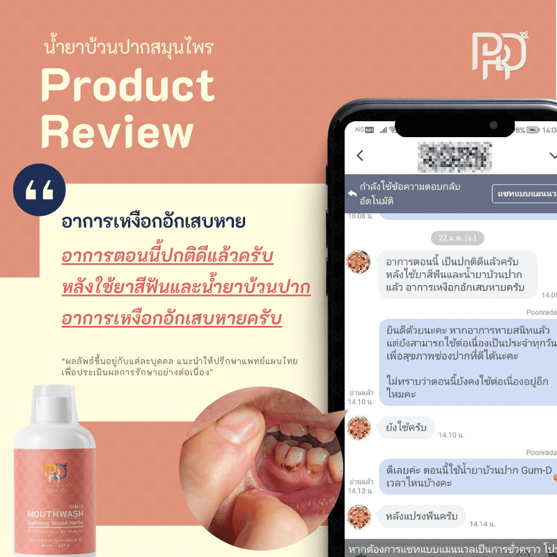รีวิวประสบการณ์ ยาแก้เหงือกอักเสบ 2