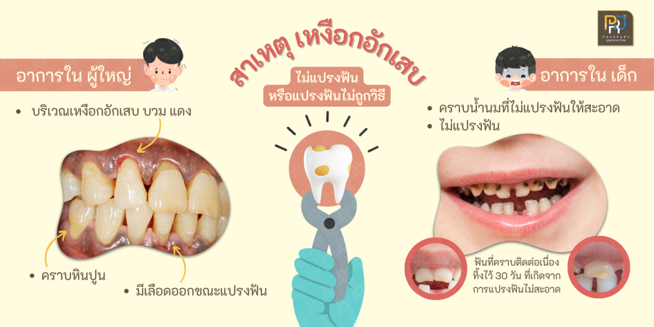 สาเหตุเหงือก อักเสบ ปวดบวม 1