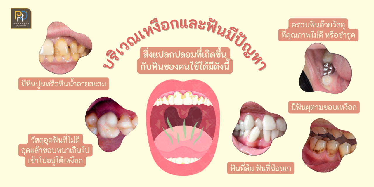 สาเหตุเหงือก อักเสบ ปวดบวม 2