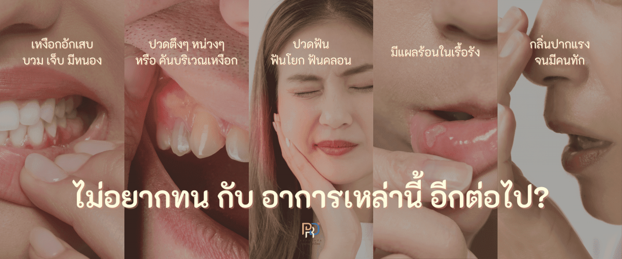 เหงือกอักเสบ อาการ