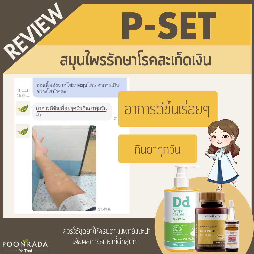 รีวิวชุดรักษาสะเก็ดเงิน4
