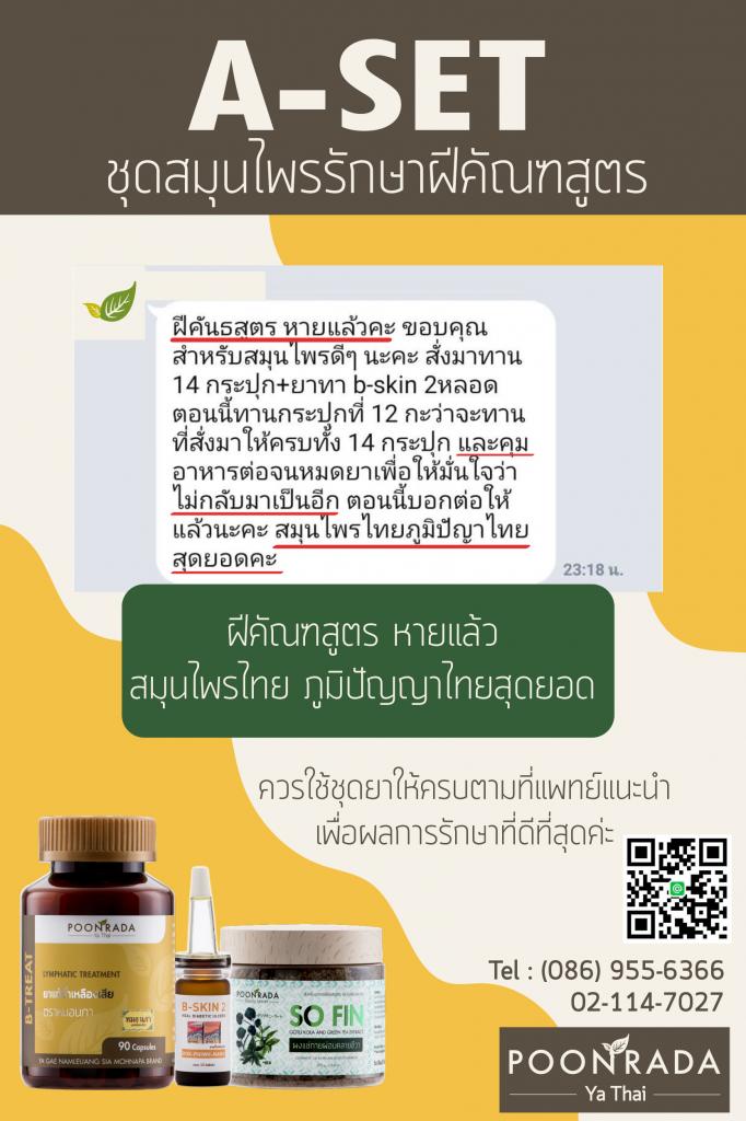 รีวิวผลการรักษาฝีคัณฑสูตร19
