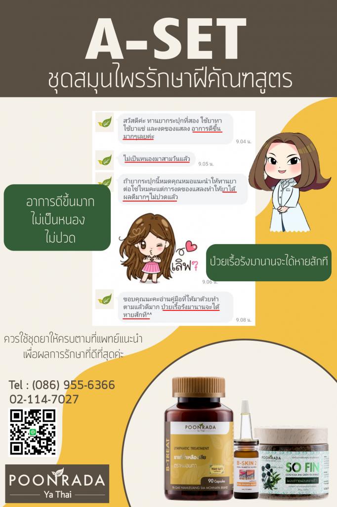 รีวิวชุดรักษาฝีคัณฑสูตร22
