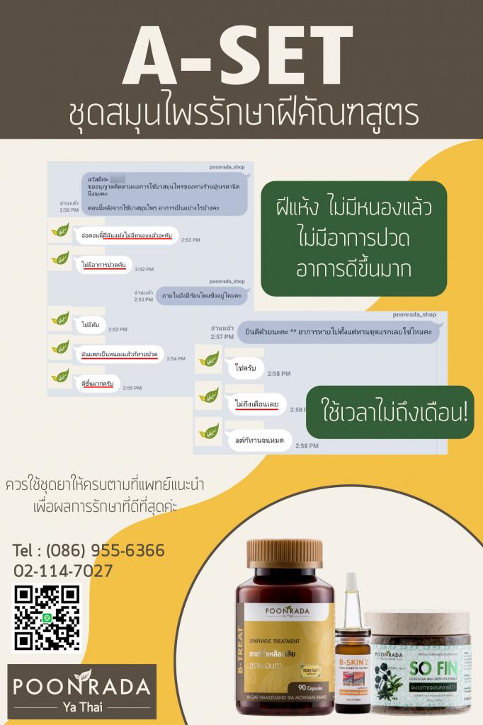 รีวิวชุดรักษาฝีคัณฑสูตร23