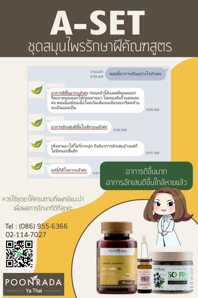 รีวิวชุดรักษาฝีคัณฑสูตร24