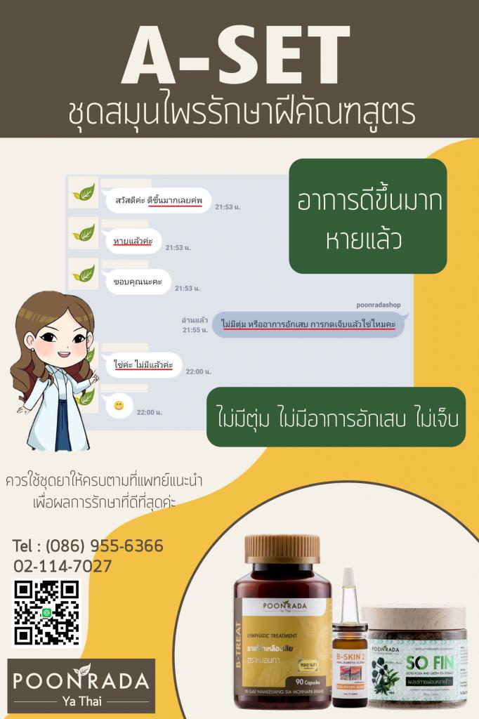 รีวิวชุดรักษาฝีคัณฑสูตร25
