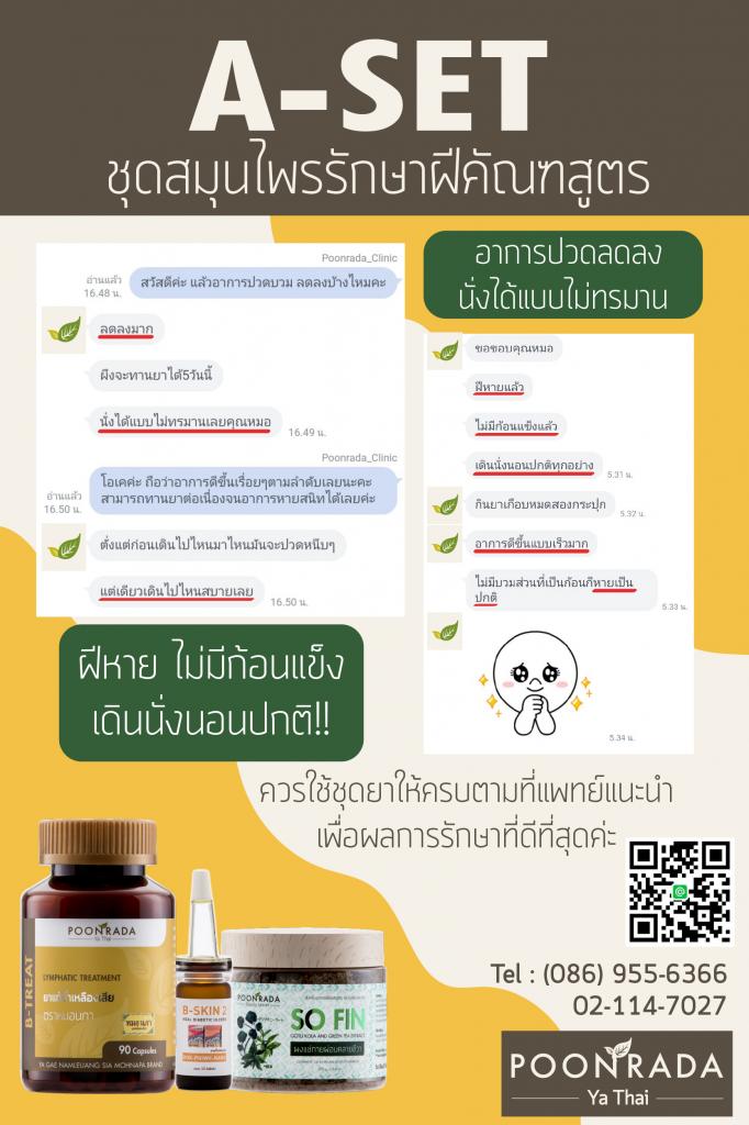 รีวิวผลการรักษาฝีคัณฑสูตร6