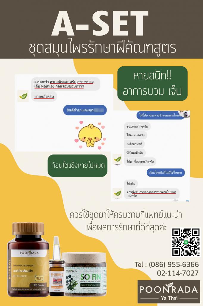 รีวิวผลการรักษาฝีคัณฑสูตร11