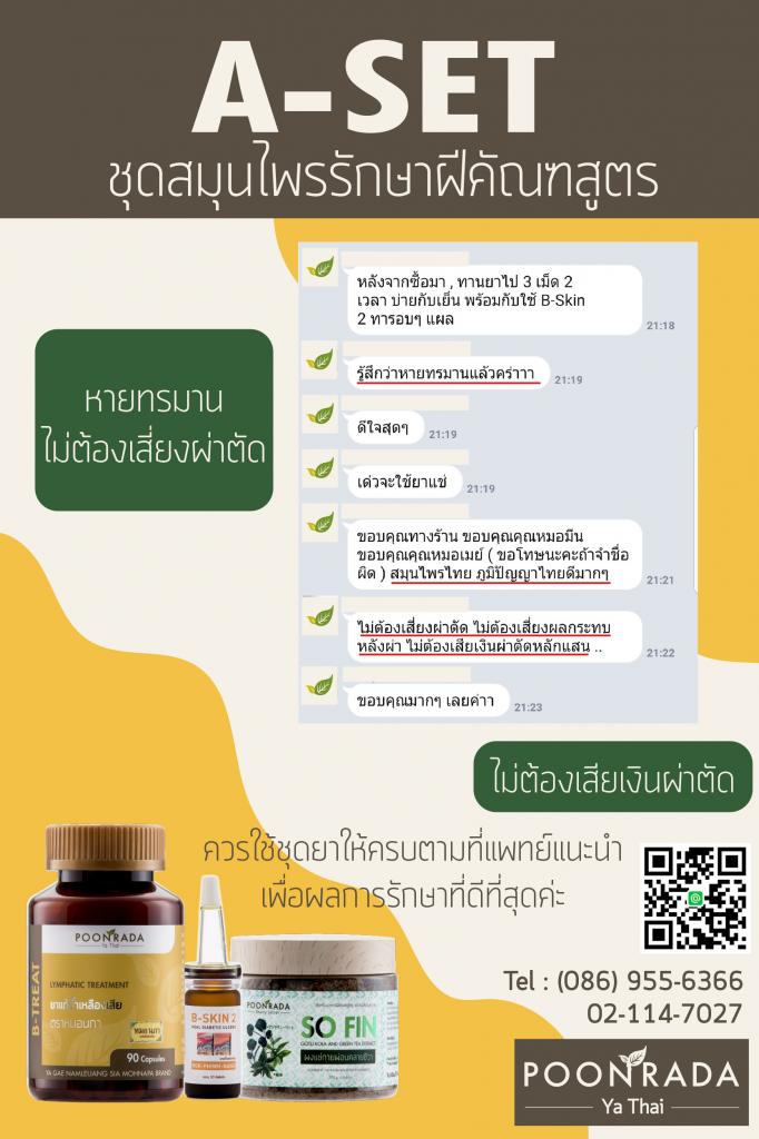 รีวิวผลการรักษาฝีคัณฑสูตร14
