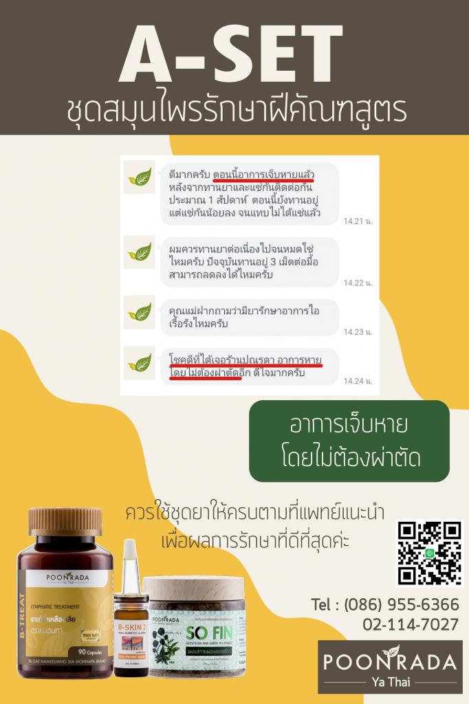 รีวิวผลการรักษาฝีคัณฑสูตร16