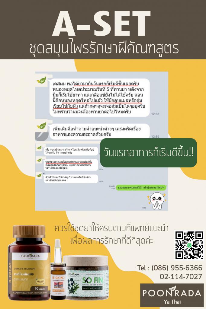รีวิวผลการรักษาฝีคัณฑสูตร17