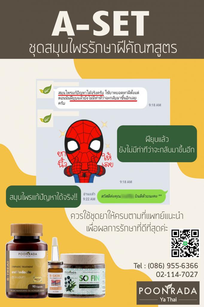 รีวิวผลการรักษาฝีคัณฑสูตร18