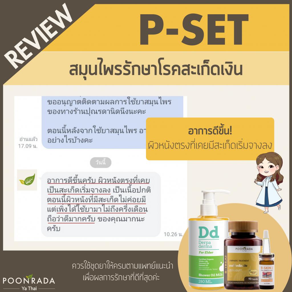 รีวิวชุดรักษาสะเก็ดเงิน