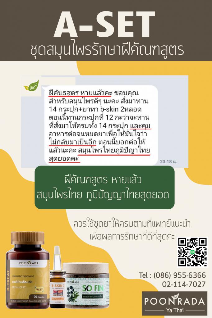 รีวิวรักษาฝีคัณฑสูตรด้วยสมุนไพรA-SET2 คนที่2