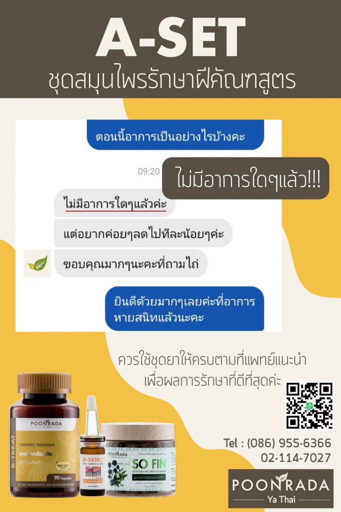 รีวิวรักษาฝีคัณฑสูตรด้วยสมุนไพรA-SET2 คนที่4