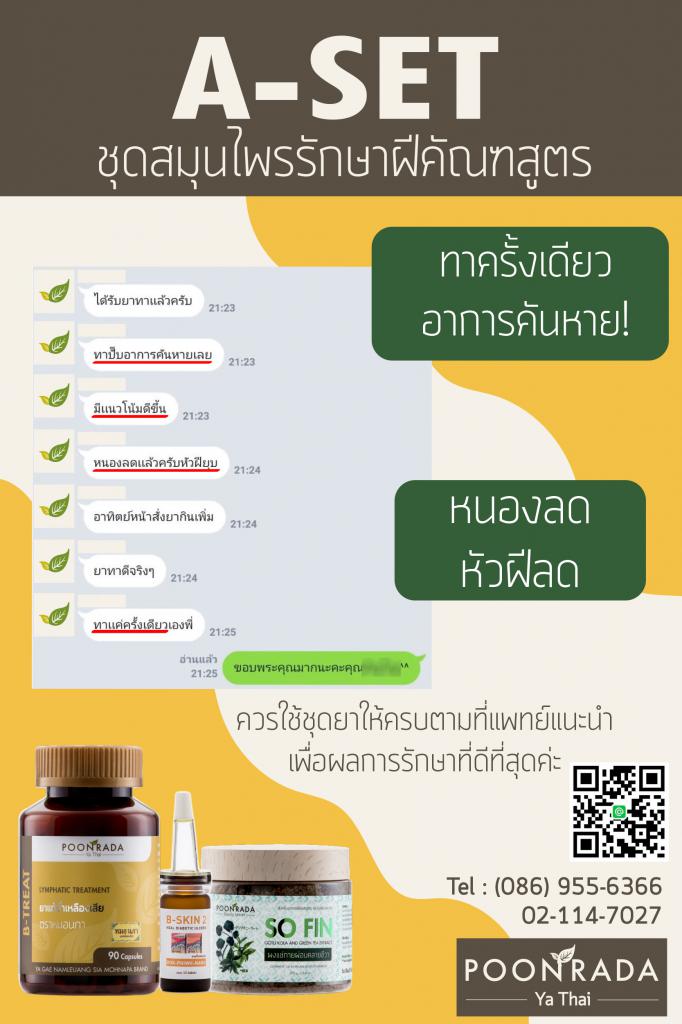 รีวิวรักษาฝีคัณฑสูตรด้วยสมุนไพรA-SET2 คนที่5